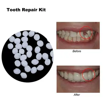 10g Pagaidu Zobu Labošanas Komplekts zobu Protēžu Līmi Zobu Balināšanas Komplekts Zobu un Nepilnības FalseTeeth Cieto Līmi Zobu Kopšanas T1179