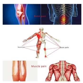 80pcs Ķīnas Sāpju Ortopēdisko Medicīnas Ģipša Pārsēja Kakla, plecu, muguras, Locītavu Sāpes Atvieglo artrīta ārstēšanai