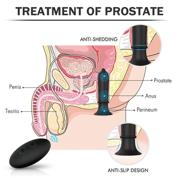 Bezvadu Tālvadības Muca Anālais Plug 9 Ātrumu Dildo Vibratoru Pāriem Tūpļa G Spot Klitora Prostatas Massager Seksa Rotaļlietas Vīriešiem/Sievietēm