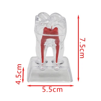 Caurspīdīgs Izņemamas Zobu Zobu Modelis Implantu Modeli Zobiem Modeļa Mācību Zobu Līdzeklis Zobu Pieaugušo Typodont Medicīnas Zinātnes