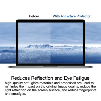 KK&LL Apple Macbook Pro Macbook retina12 collu Modelis A1534 kristāldzidru Lcd Aizsargs Filmu Ekrāna filmu Aizsargs