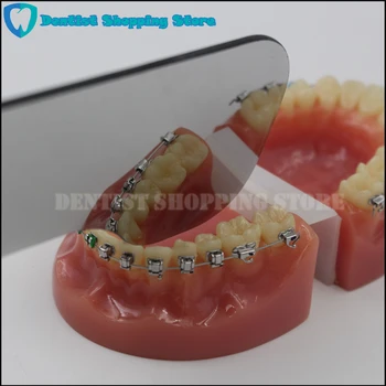 Ortodontijas Zobu Foto Stikla Spoguļi Dubultā Sānu Zobārstniecības Klīnika Pārbaude