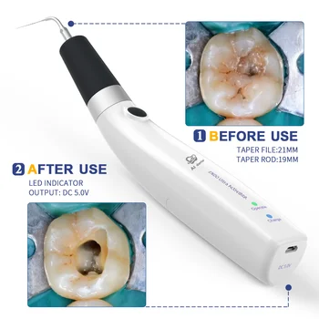 Portatīvo uzlādējamās zobu ultraskaņas aktivators endo failus irrigator handpiece, lai saknes kanāla sagatavošana