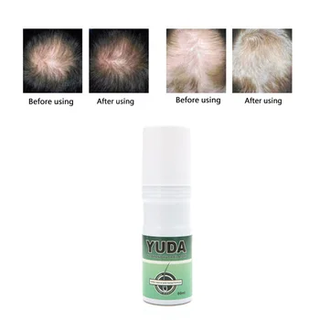 Yuda Pilatory Matu Regrowth Šķidrs Produkts, Anti Alopēcija Ārstēšanai Baldness 60ML 896D